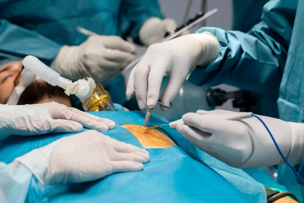 Exploring the Advantages of Laparoscopic Surgery