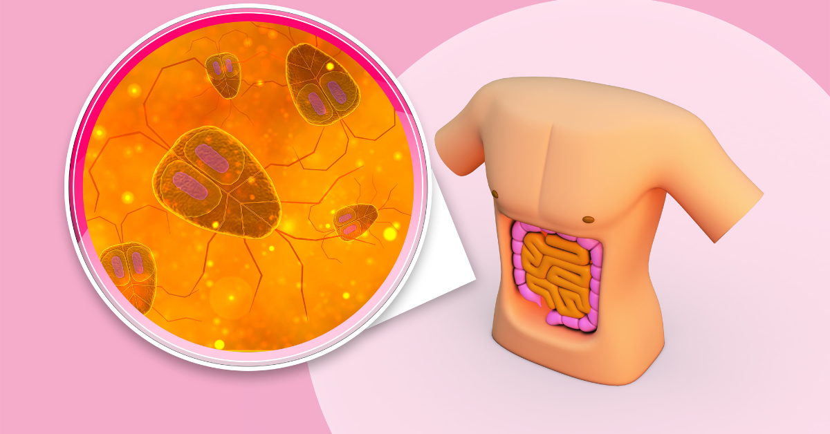 Role of Mesh in Hernia Repair