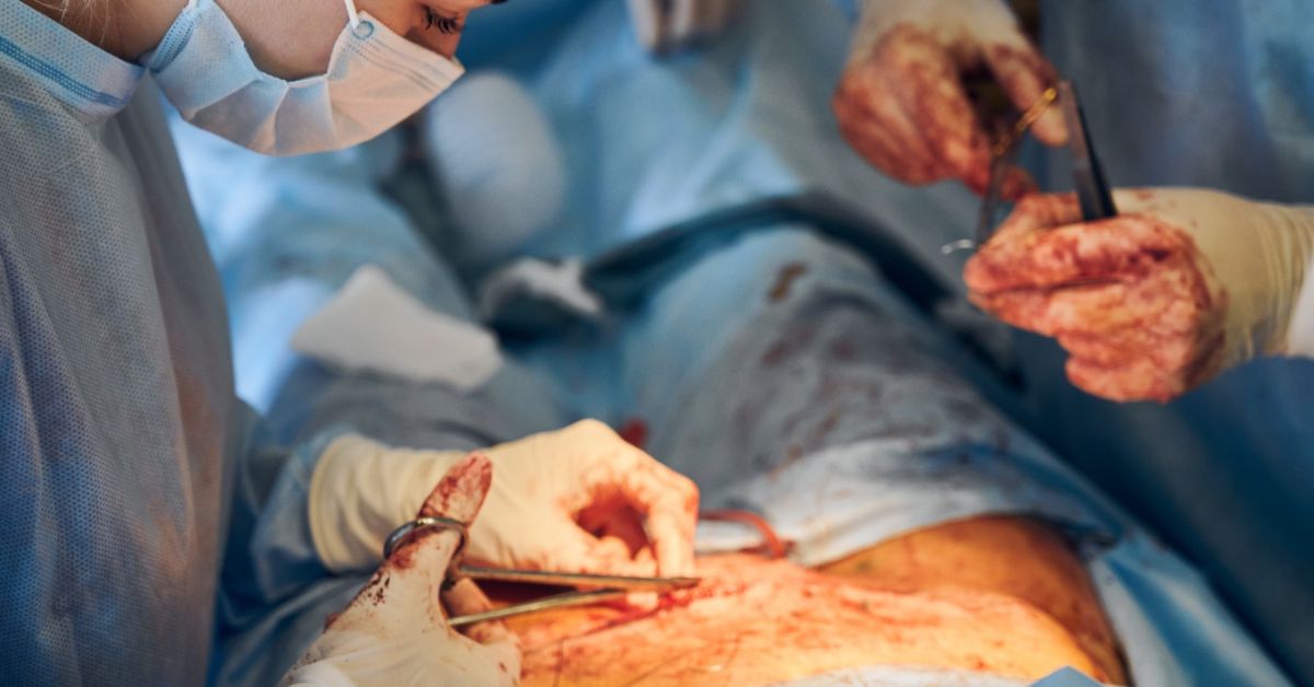 यदि हर्निया का वर्षों तक उपचार न किया जाए तो क्या होता है?