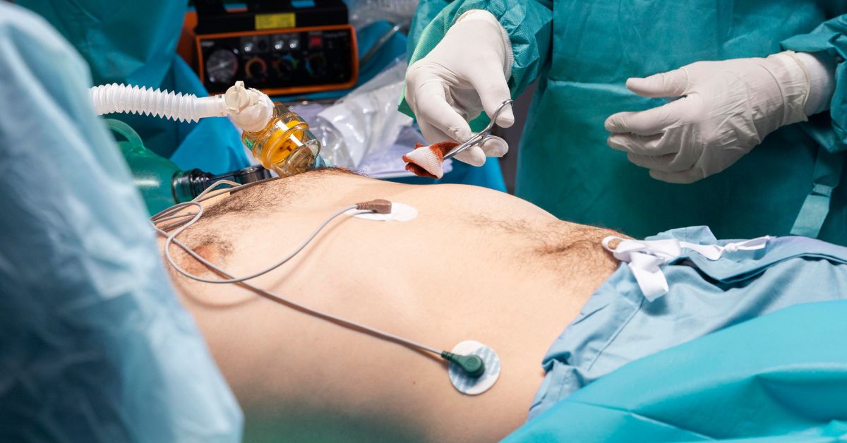 हर्निया के इलाज में देरी क्यों होती है और इसके क्या परिणाम होते हैं